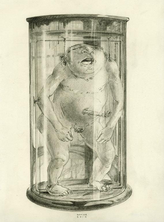 Foetus humain anencéphale mâle dans un bocal, musée Dupuytren, Paris