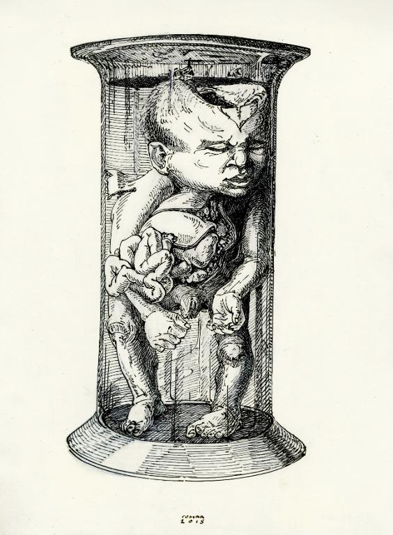 Foetus humain femelle éventrée dans un bocal, musée Dupuytren, Paris