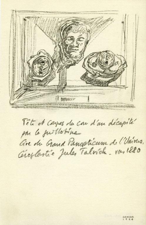 Tête et coupes du cou d'un guillotiné, collection du Dr Spitzner, musée Orfila, Paris